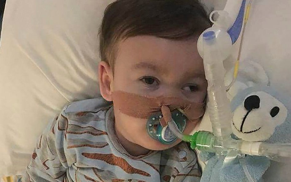 Alfie Evans zmarł w nocy