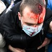 Mężczyzna ranny w czasie demonstracji w Moskwie