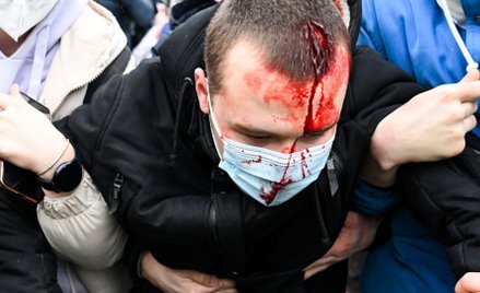 Mężczyzna ranny w czasie demonstracji w Moskwie