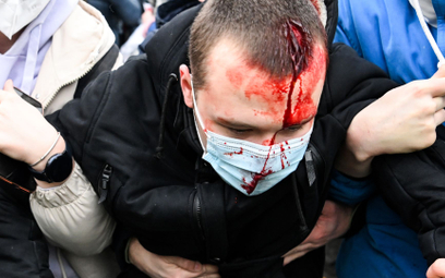 Mężczyzna ranny w czasie demonstracji w Moskwie