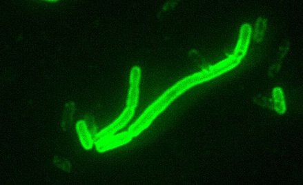 Naukowcy: "Czarna śmierć" pochodziła z Rosji