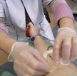 Sukces terapii genowej w leczeniu szpiku