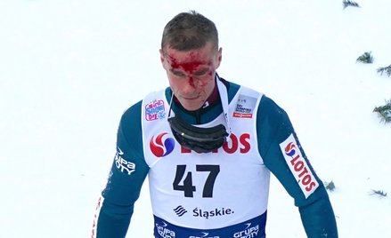 Wisła: Fatalny wypadek Piotra Żyły na skoczni