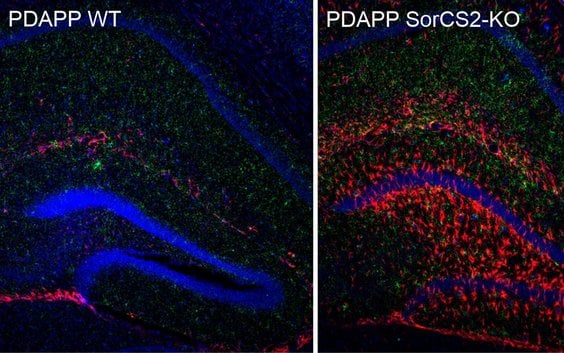 Zdjęcia mikroskopowe skrawków mózgu myszy „alzheimerowych” produkujących białko SorCS2 (po lewej) i 