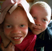 Rzeź albinosów w Tanzanii