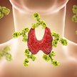 Choroby zapalne tarczycy należą do częstych schorzeń autoimmunologicznych, jakie atakują głównie kob