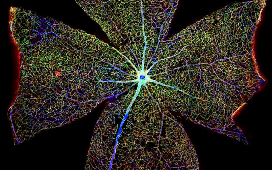 Fot: Gabriel Luna. Zdjęcie pokazuje siatkówkę znajdującą się w tylnej części oka.