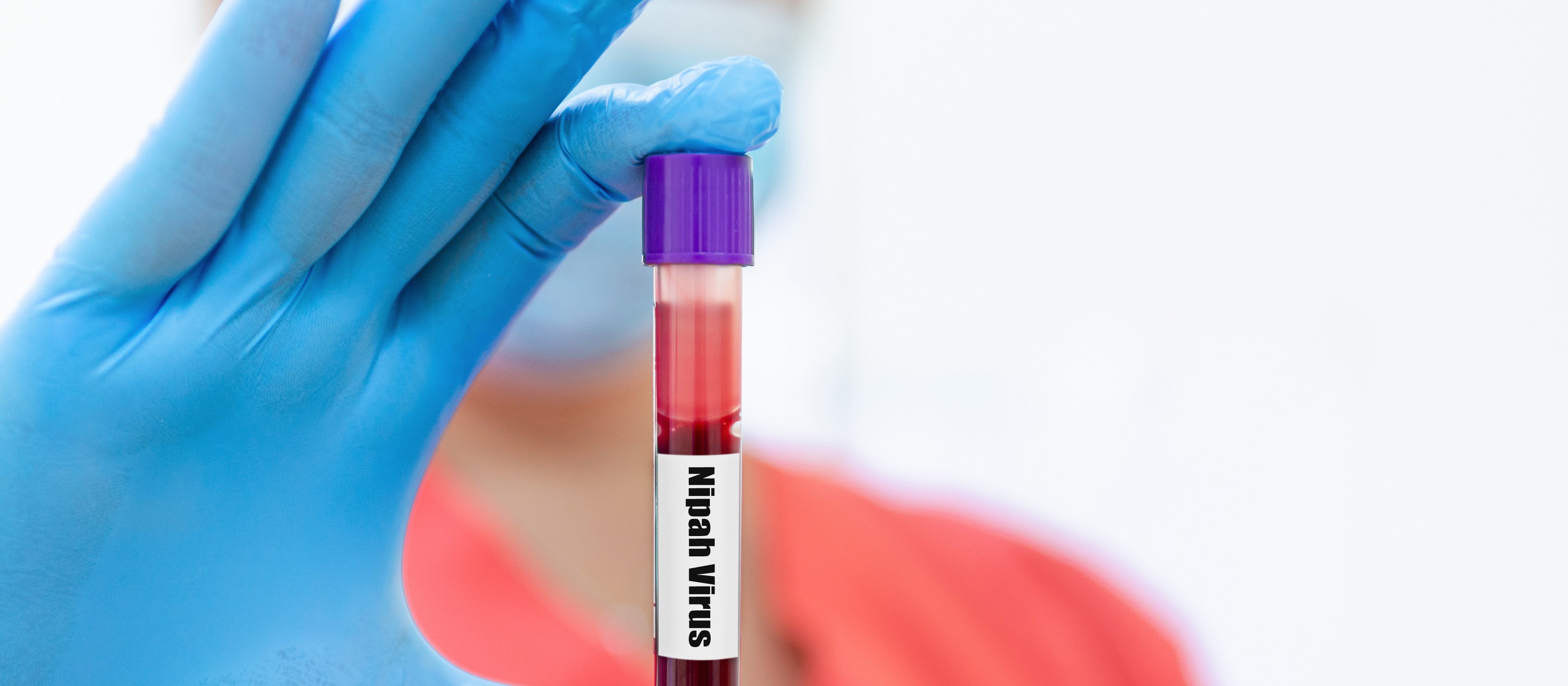 Stan najwyższej gotowości w Azji. Jakie zagrożenie niesie wirus Nipah?