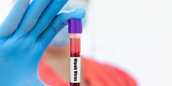 Stan najwyższej gotowości w Azji. Jakie zagrożenie niesie wirus Nipah?