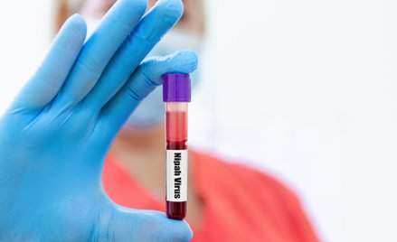 Wskaźnik śmiertelności w przypadku wirusa Nipah wynosi od 40 do 75 proc.