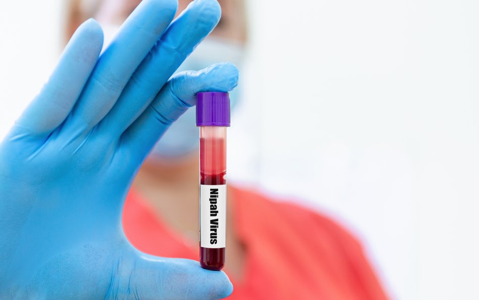 Wskaźnik śmiertelności w przypadku wirusa Nipah wynosi od 40 do 75 proc.