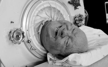 Paul Alexander zmarł w poniedziałek. Niemal 70 lat spędził w "żelaznym płucu"