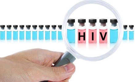 Lekarze nie zgłaszają zakażeń HIV