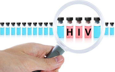 Lekarze nie zgłaszają zakażeń HIV