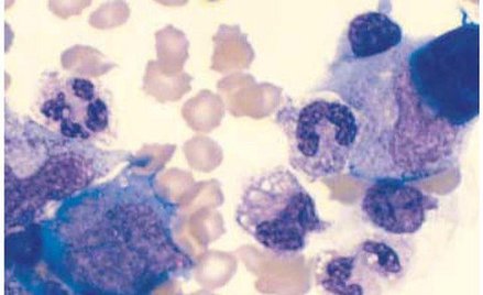 Groźna, obiecująca terapia