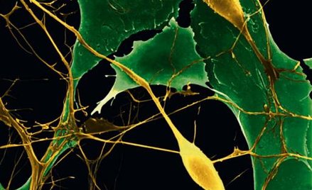Ok. 100 mld neuronów (komórek nerwowych) znajduje się w mózgu człowieka