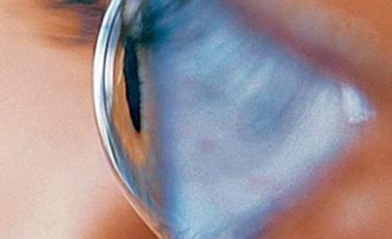 Wrodzona ślepota Lebera stała się chorobą, którą można pokonać terapią genową