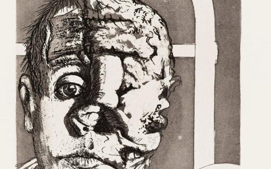 Otto Dix, „Transplantacja” (z teki „Wojna”, 1924): człowiek-słoń spod Verdun