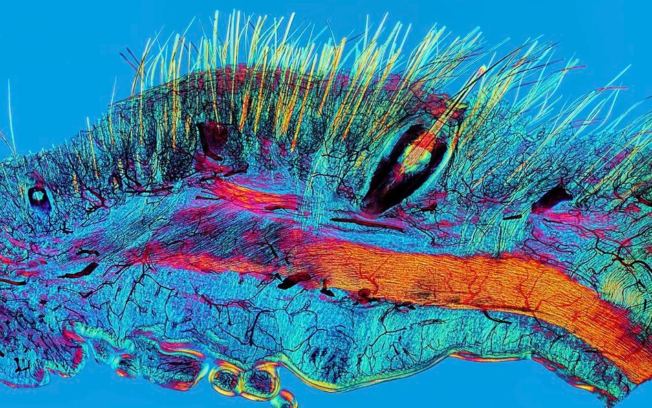 Fot: David Linstead. Zdjęcie pokazuje spolaryzowane światło mikrogramu fragmentu skóry kota