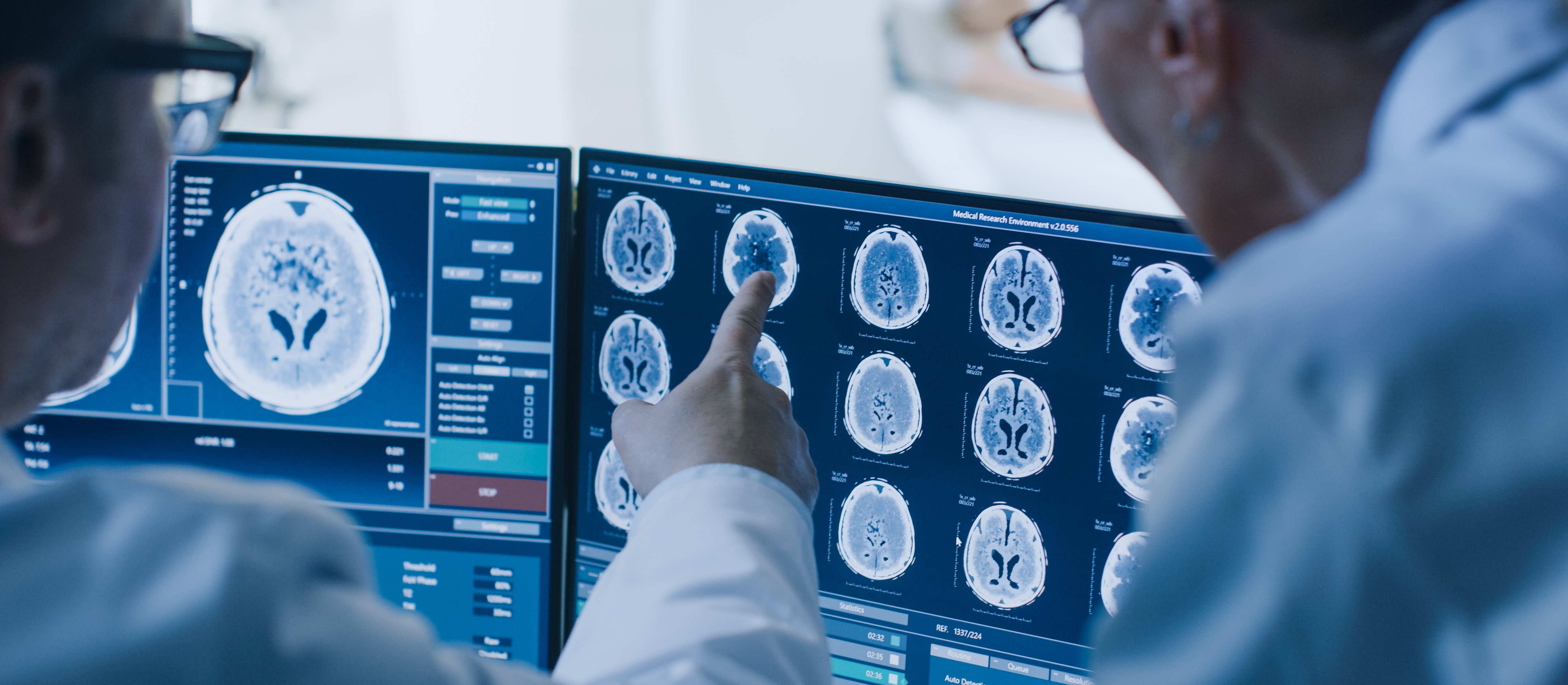 Naukowcy podzielili ADHD na trzy biotypy. Kryterium nie były objawy, ale mózg