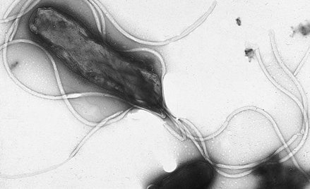 Helicobacter pylori. Fot. Yutaka Tsutsumi