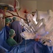 Operowana robotem da Vinci zmarła. Prawnicy tłumaczą, czym jest eksperyment medyczny