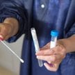 Koronawirus: mniej szpitali jednoimiennych, lekarz pierwszego kontaktu zleci test na Covid-19