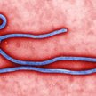 Wirus Ebola wciąż zabija w Afryce Zachodniej