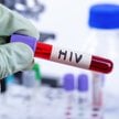 Zaskakujące ustalenia naukowców. Epidemia HIV miała wpływ na ludzką ewolucję