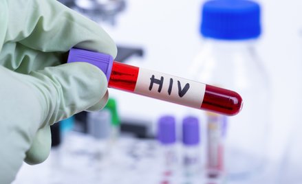Zaskakujące ustalenia naukowców. Epidemia HIV miała wpływ na ludzką ewolucję