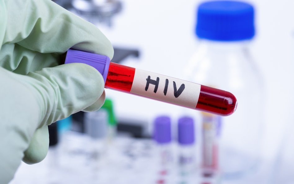 Zaskakujące ustalenia naukowców. Epidemia HIV miała wpływ na ludzką ewolucję