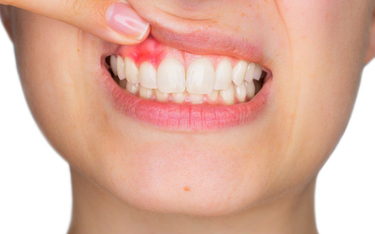 Jama ustna to nie tylko zęby, ale też przyzębie, czyli zespół tkanek otaczających i unieruchamiający