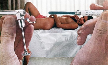 Bicillin z cyklu Body Beautiful, or Beauty Knows No Pain, (c 1965-72); fotomontaż; dzięki uprzejmośc