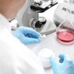 Odpisy amortyzacyjne od kosztów prac rozwojowych w B+R