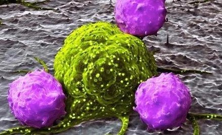 Dwa białka – nadzieja na leczenie nowotworów