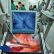 Prototyp polskiego robota kardiochirurgicznego