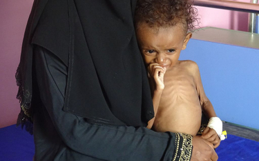 "Dzieci w Jemenie z głodu ledwie otwierają oczy"