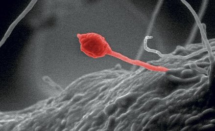 Gliocladium roseum to grzyby, które potrafią rozkładać celulozę. W wyniku tej reakcji powstają podst