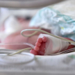 Trzymiesięczne niemowlę: złamania wszystkich kości kończyn