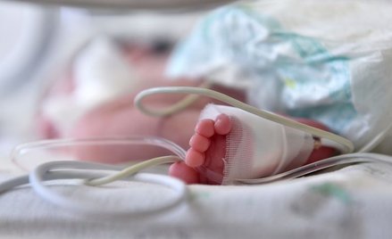 Trzymiesięczne niemowlę: złamania wszystkich kości kończyn