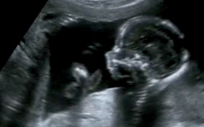 Nowe przepisy w Ohio: aborcja niedozwolona po wykryciu bicia serca dziecka