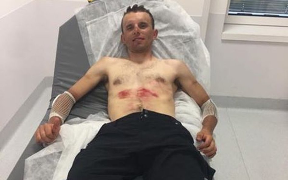 Rafał Majka w szpitalu. Od wyników badań zależy jego dalszy udział w wyścigu