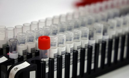 PILNE Epidemia w Polsce: 10 241 nowych zakażeń, zmarło 45 osób