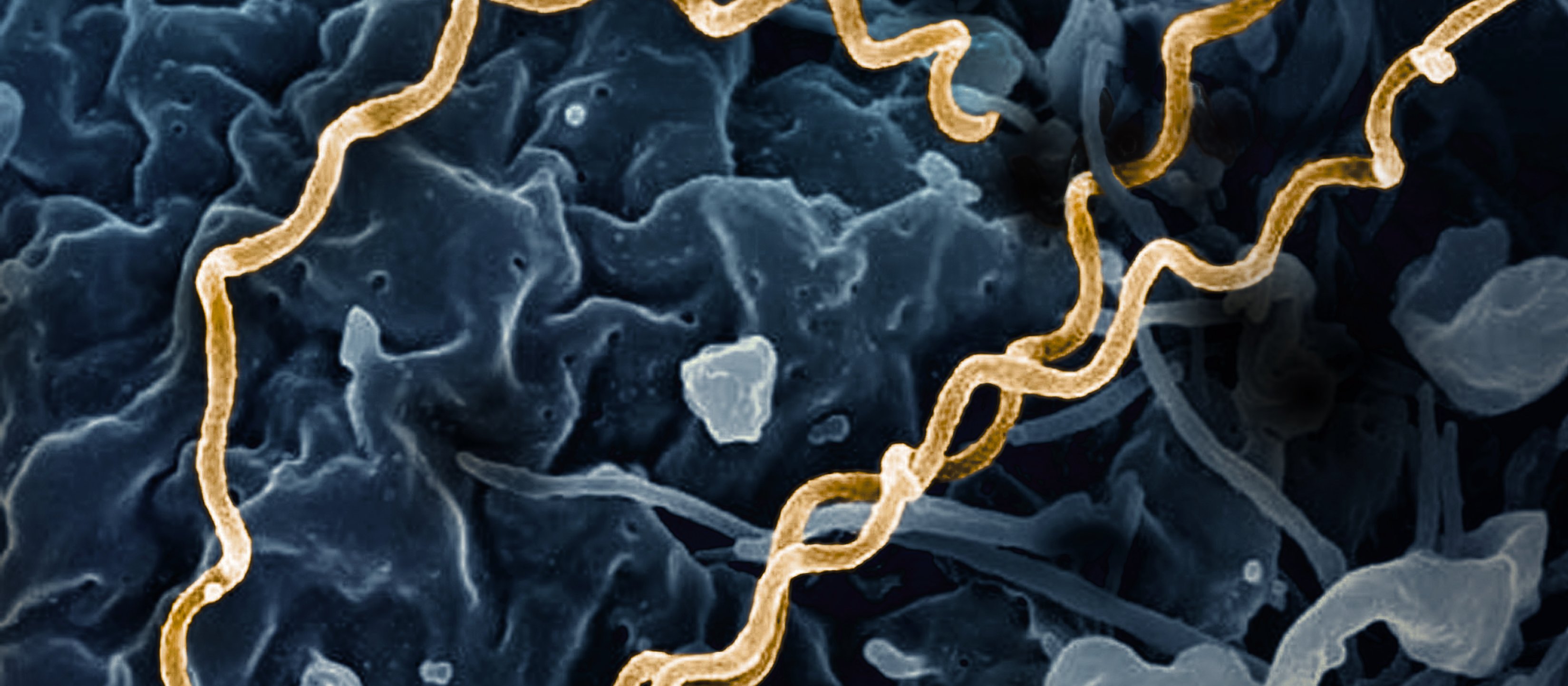 Skąd naprawdę pochodzi kiła? Starożytne DNA podważa europejską wersję historii