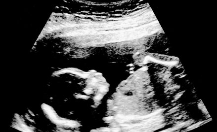 Belgia: Możliwa legalna aborcja do 18. tygodnia. Biskupi protestują