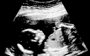 Belgia: Możliwa legalna aborcja do 18. tygodnia. Biskupi protestują
