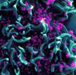 Według oficjalnych danych zakażonych wirusem HIV (na zdjęciu) jest w Polsce ok. 19 tys. osób, czyli 