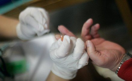 Cukrzyca osłabia mózg