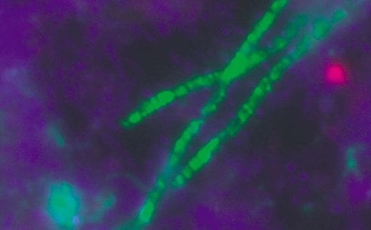 Acidobacteria. Źródło: U.S. Department of Energy Genome Programs /The Encyclopedia of Life