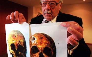 Lekarze z "Jednostki 731" dokonywali trepanacji czaszki i operacji wycięcia części mózgu